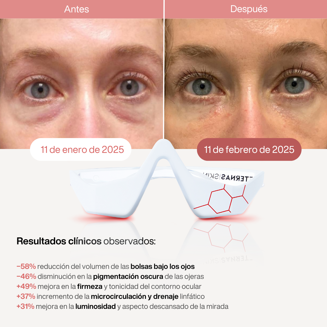 Reparador Bolsas y Ojeras con LED y Microcorriente - HairFluencer