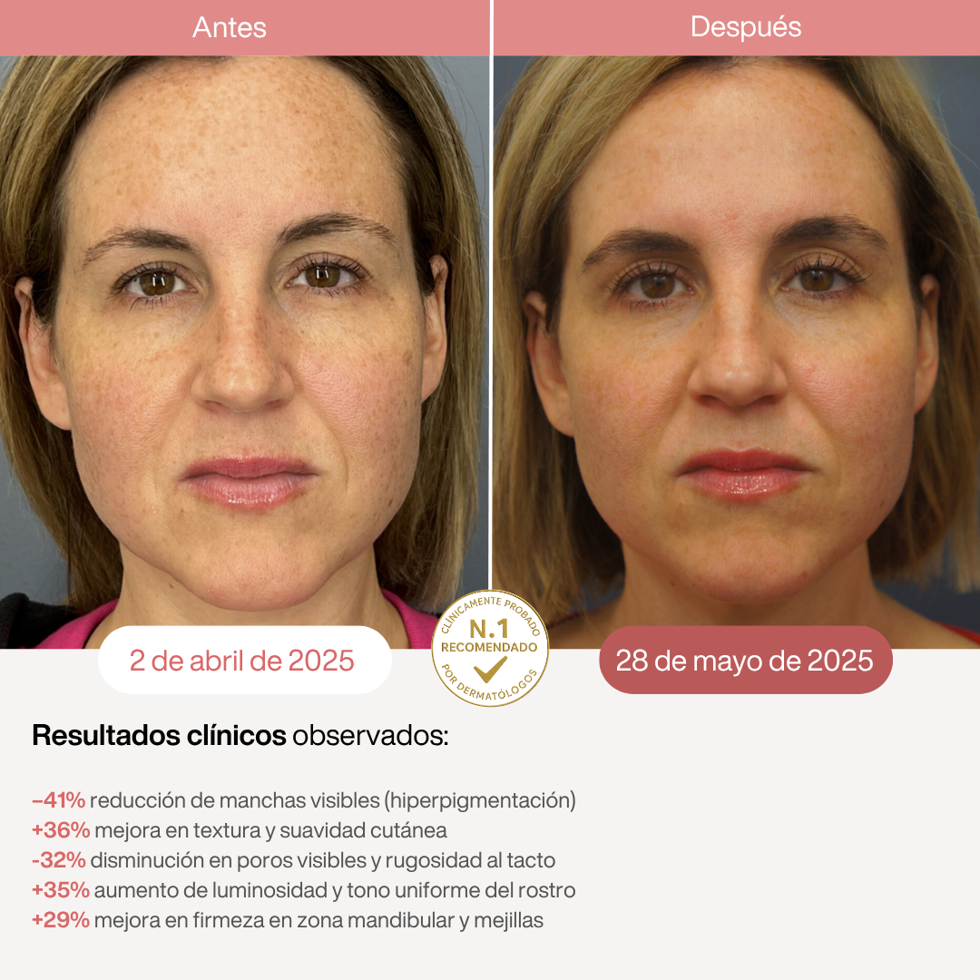 Máscara LED Infrarroja Profesional - 850nm - HairFluencer