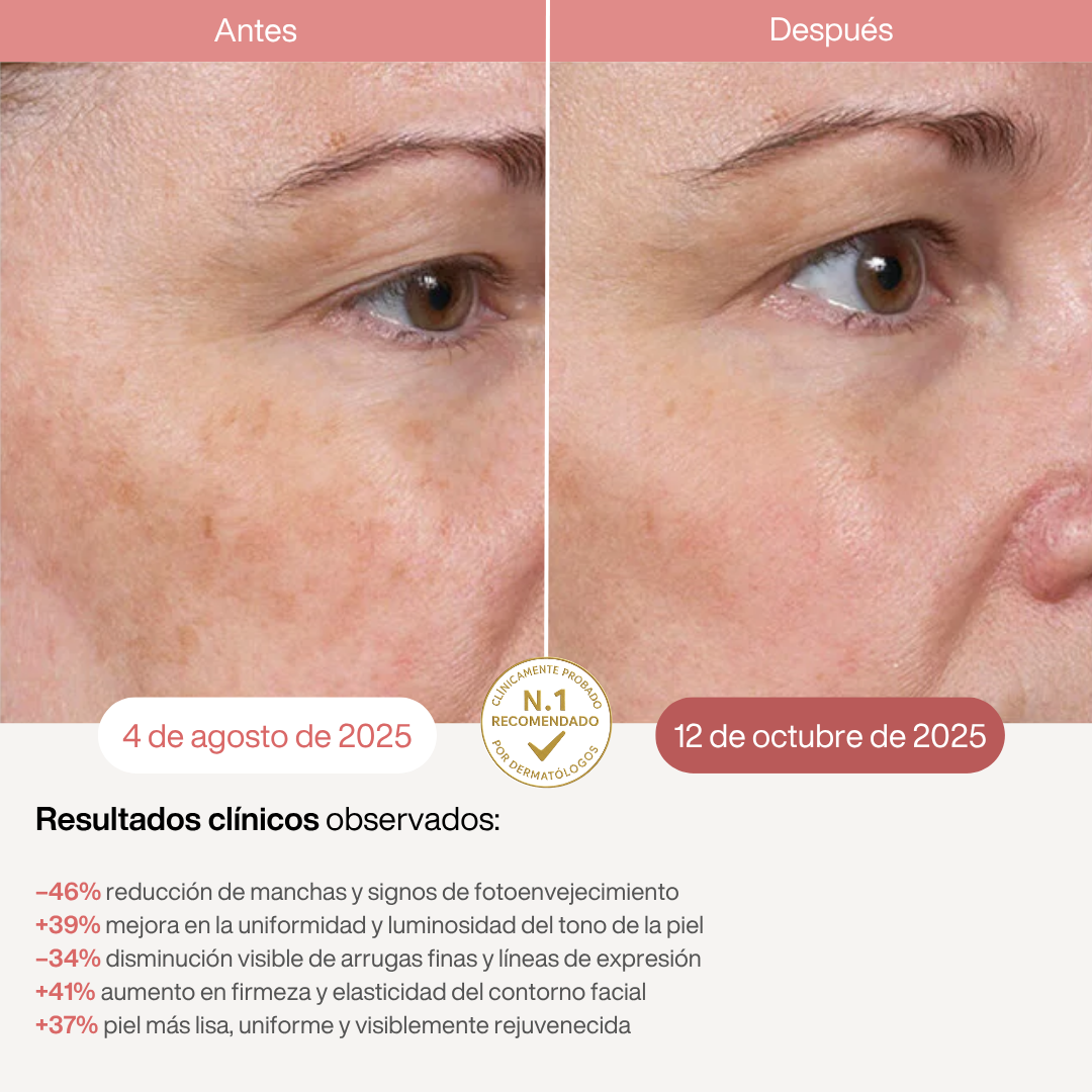 Máscara LED Infrarroja Profesional - 850nm - HairFluencer