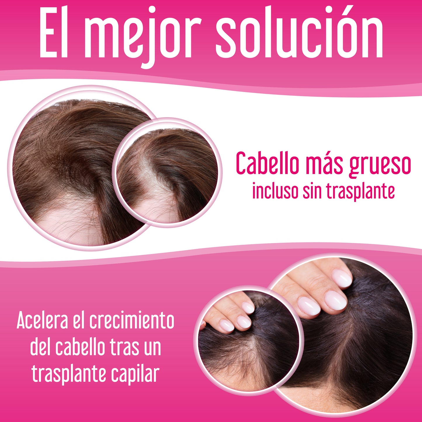 Xpecia Tablet mujer vitaminas para alopecia, Bloqueador DHT, vitaminas y minerales necesarias para que el cabello y la piel estén saludables