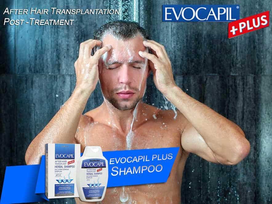 Evocapil Plus Anti-Hair Loss Shampoo 300 ml PH 5.5 - Specially designed for after a hair transplant